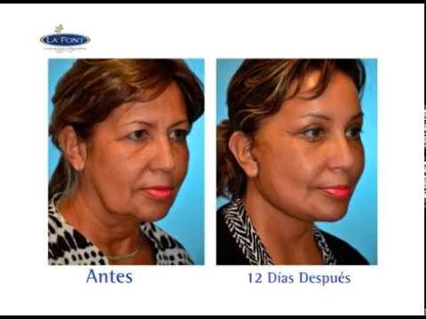 Terapias de Rejuvenecimiento Facial en Bogot&aacute;: Gu&iacute;a Completa